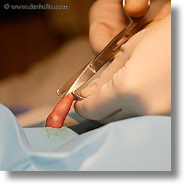 http://www.danheller.com/images/Topics/Circumcision/circumcision-05.jpg