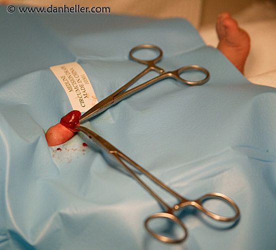 circumcision-09.jpg