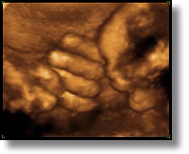 babies, boys, horizontal, infant, jacks, ultrasound, photograph