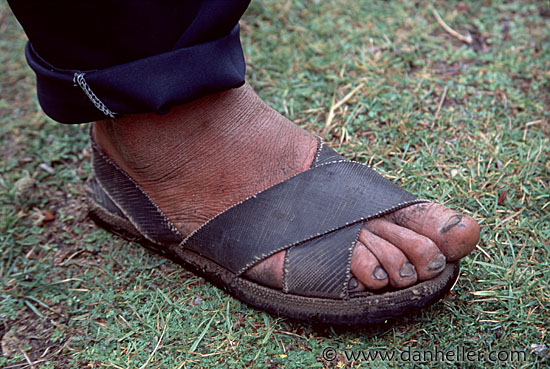 porters-foot.jpg