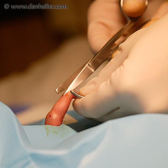 circumcision-05.jpg
