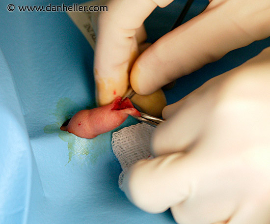 circumcision-06.jpg
