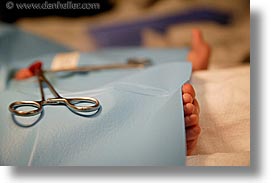 images/Topics/Circumcision/circumcision-11.jpg