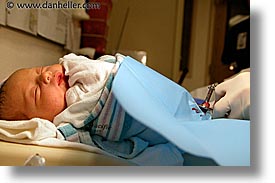 images/Topics/Circumcision/circumcision-14.jpg