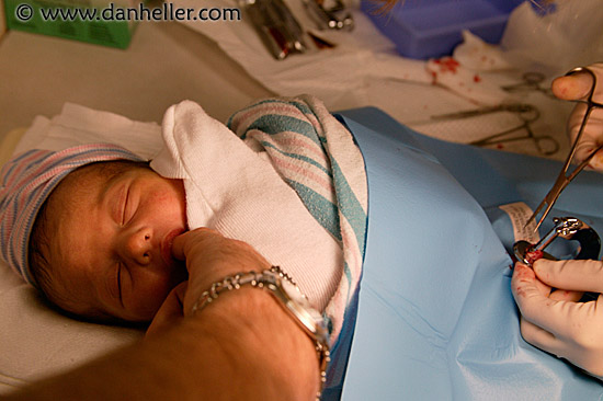 circumcision-15.jpg