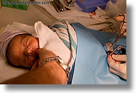 images/Topics/Circumcision/circumcision-15.jpg