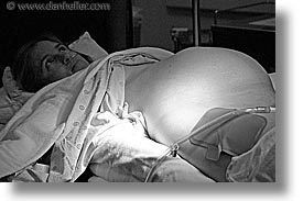 images/personal/Jack/Birth/Preparation/pre-cut-tummy-bw.jpg