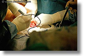 images/personal/Jack/Birth/Preparation/surgery-hands-1.jpg