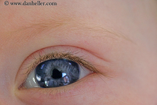 jack-left-eye.jpg