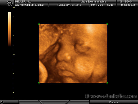 ultrasound-1.jpg