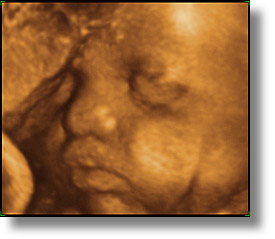 babies, boys, horizontal, infant, jacks, ultrasound, photograph