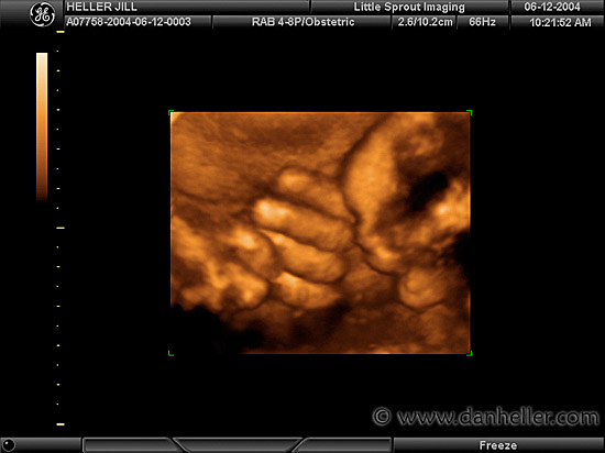 ultrasound-3.jpg